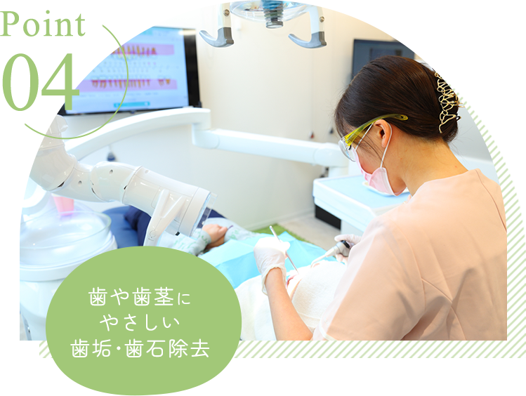 歯や歯茎にやさしい歯垢・歯石除去